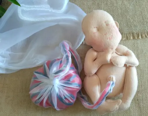 Bebê, Saco Amniótico e Placenta