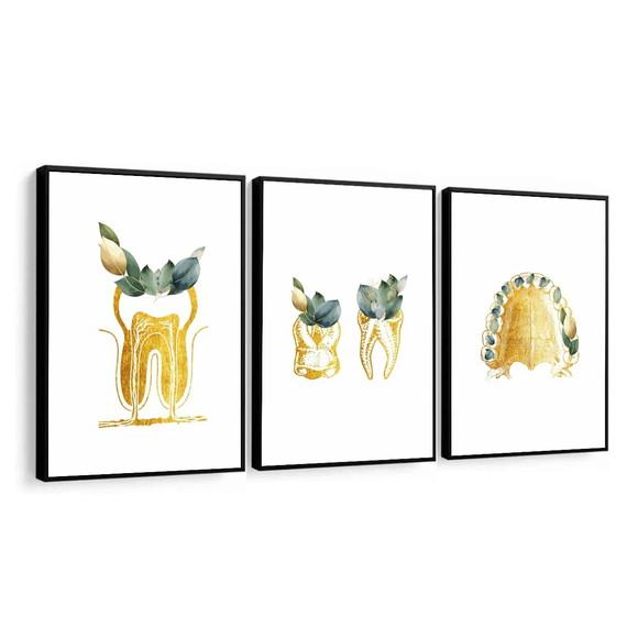 3 Quadros Decorativos Odontologia Consultório Dourado Vidro