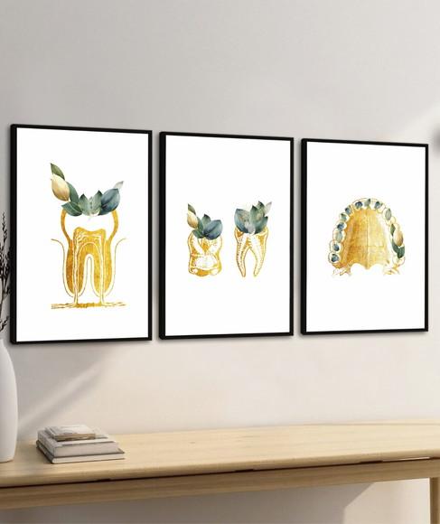 3 Quadros Decorativos Odontologia Consultório Dourado Vidro