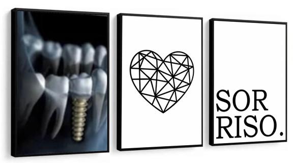 Kit 3 Quadros Decorativos Consultório Dentista Sala Moldura