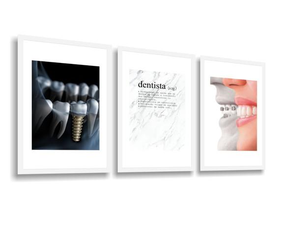 Kit 3 Quadros Decorativos Consultório Odontologia Profissão