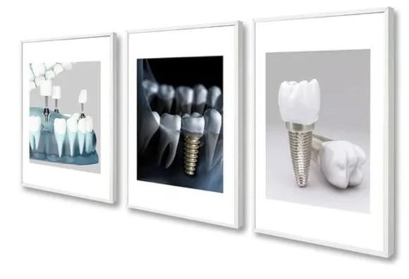 Kit 3 Quadros Decorativos Dentista Consultório Com Moldura