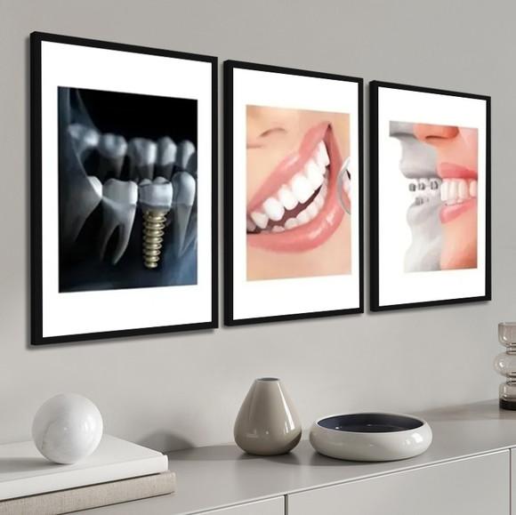 Kit 3 Quadros Decorativos Dentista Odontologia Consultório