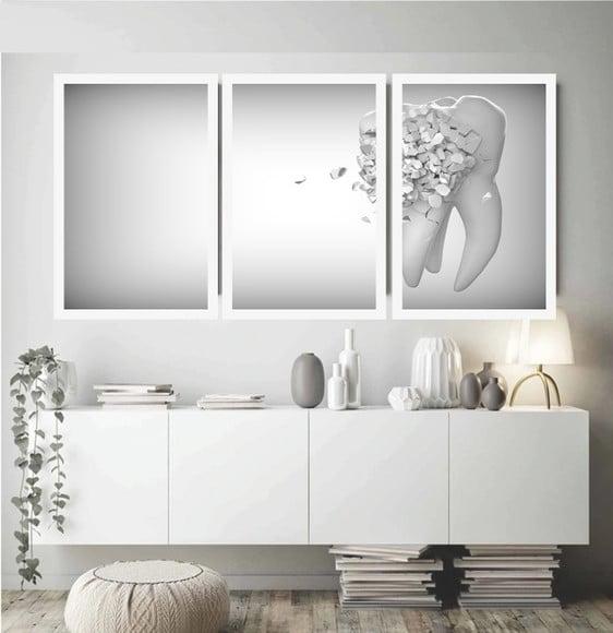 Kit 3 Quadros Decorativos Odontologia Consultório Dentistas