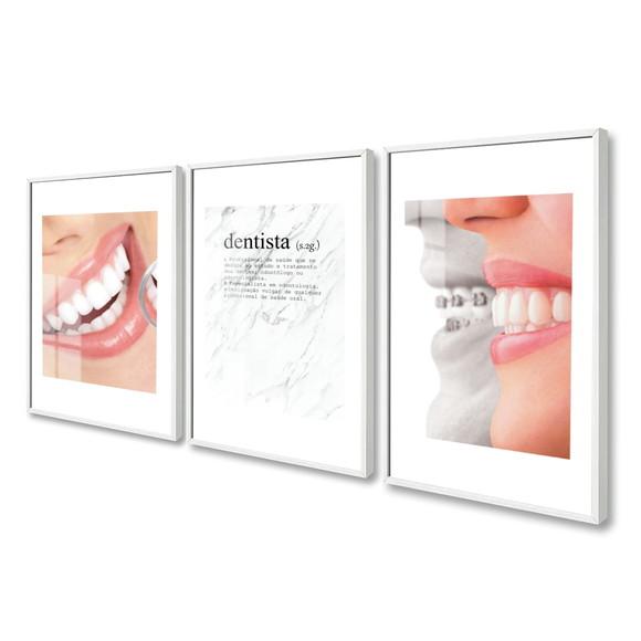 Kit Quadros Decorativos Dentista Consultório Moldura e Vidro