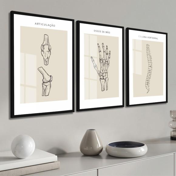 Quadros Decorativos Medicina Ortopedia Consultório com Vidro