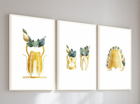 Quadros Decorativos Odontologia Consultório Dourado Vidro