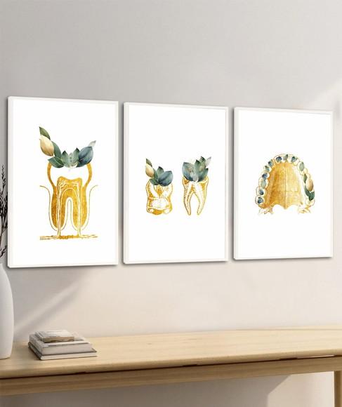 Quadros Decorativos Odontologia Consultório Dourado Vidro