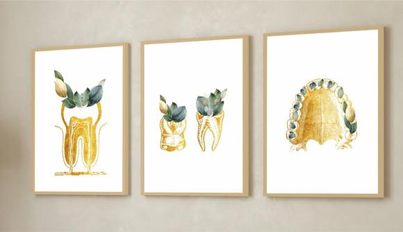 Quadros Decorativos Odontologia Consultório Dourado Vidro