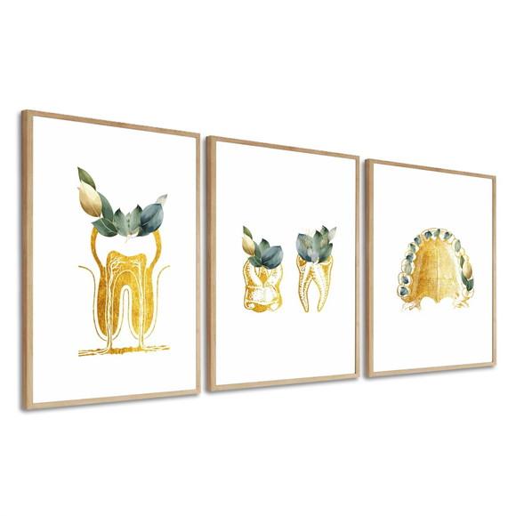 Quadros Decorativos Odontologia Consultório Dourado Vidro