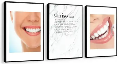 3 Quadros Odontologia Dentistas Decoração Conjunto Molduras