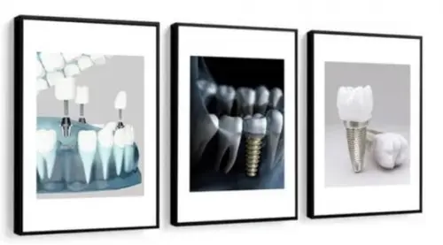 Kit 3 Quadros Decorativos Consultório Dentista Com Moldura