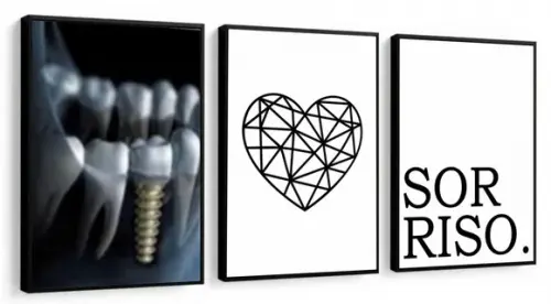 Kit 3 Quadros Decorativos Consultório Dentista Sala Moldura
