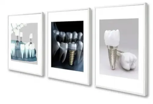 Kit 3 Quadros Decorativos Dentista Consultório Com Moldura
