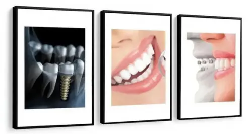 Kit 3 Quadros Decorativos Dentista Odontologia Consultório