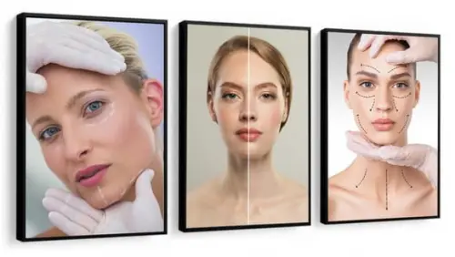 Kit 3 Quadros Estética Botox Profissão Decoração Spa Moldura