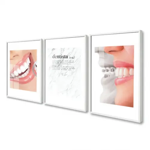 Kit Quadros Decorativos Dentista Consultório Moldura e Vidro