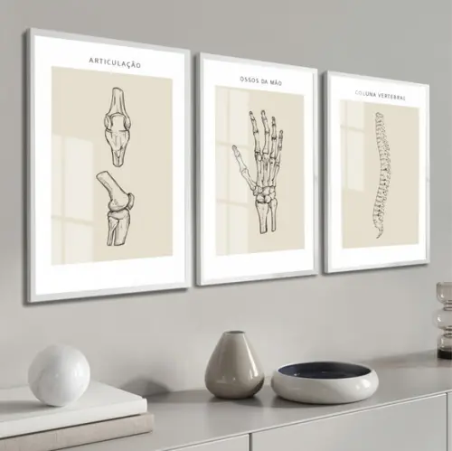 Quadro Decorativo Medicina Ortopedia Consultório Luxo Vidro