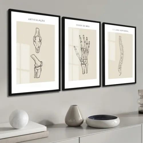 Quadros Decorativos Medicina Ortopedia Consultório com Vidro
