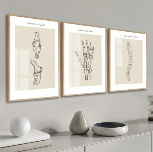 Quadros Decorativos Medicina Ortopedia Consultório com Vidro