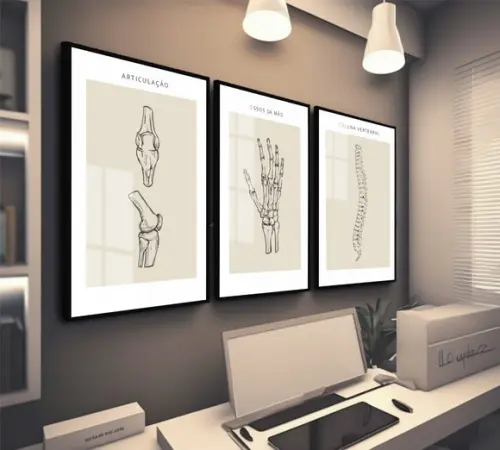 Quadros Decorativos Medicina Ortopedia Consultório com Vidro