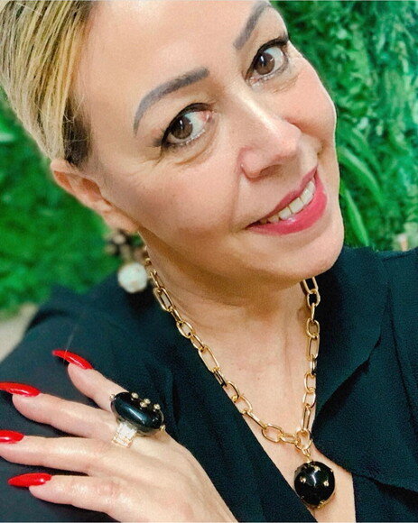Conjunto Bolas Resinas Preta e Branco