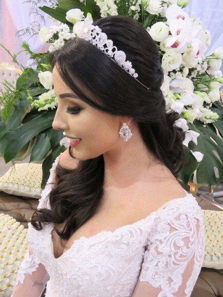 Coroa de Zircônia