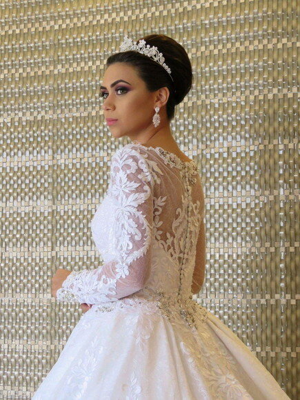 Coroa de Zircônia