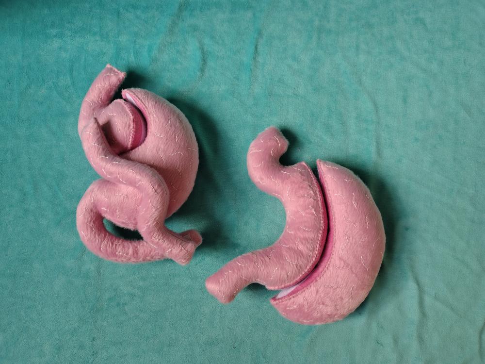 Kit Estômago Cirurgia Bariátrica Sleeve e Bypass de Pelúcia