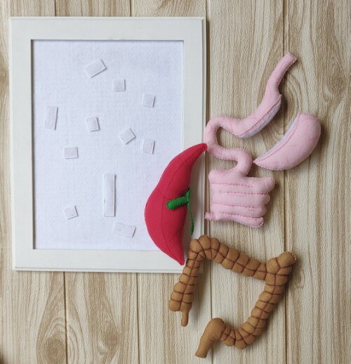 Kit Maquete Cirurgia Bariátrica Sleeve e Bypass de Feltro