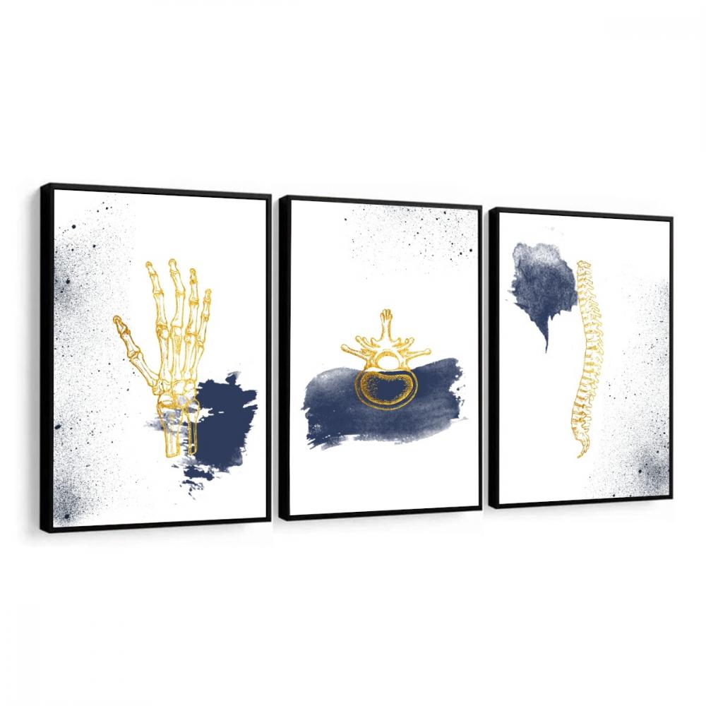 kit 3 quadro decorativo ortopedia consultório de ortopedista oss
