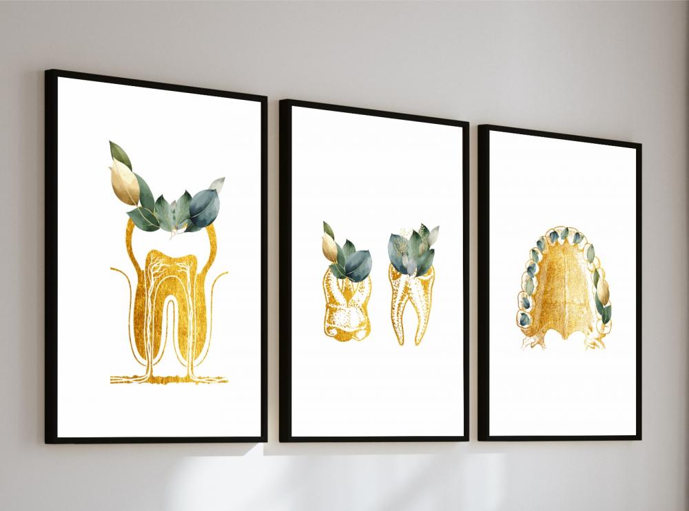 kit 3 quadro decorativo odontologia dentista boca dente consultó