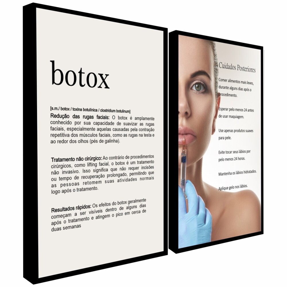 kit 2 quadro decorativo botox rosto harmonização facial dermato