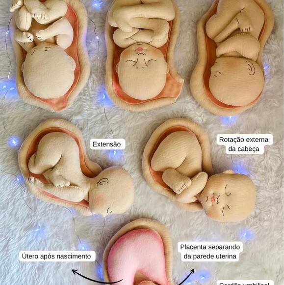 Kit Estágios do Parto Normal e Anatomia da Cesária