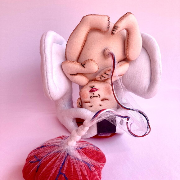 Pelve e Bebe com Placenta