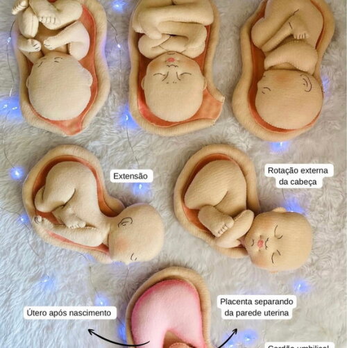 Kit Estágios do Parto Normal e Anatomia da Cesária