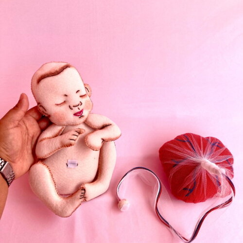 Pelve e Bebe com Placenta